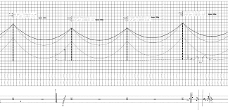 power line parabola