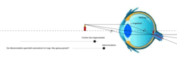 Wie das Auge Bilder scharf stellt - und wie Brillen helfen